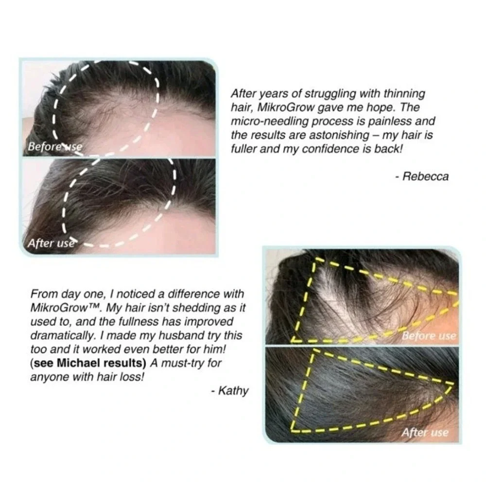 Mikro Re:Grow Your Own Hair Thicker Fuller  1 Month Supply